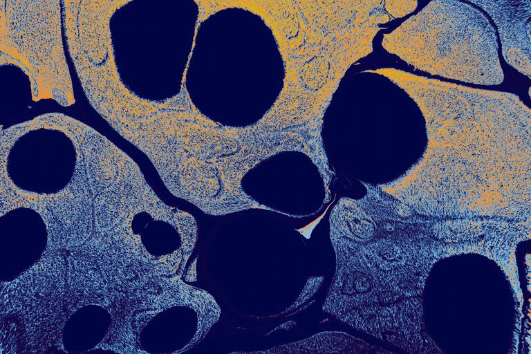 Artistic abstract image featuring blue and yellow textures with circular patterns.